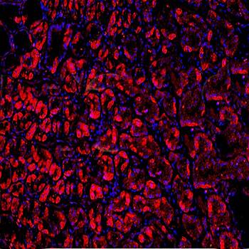 VPS18 Rabbit Polyclonal Antibody