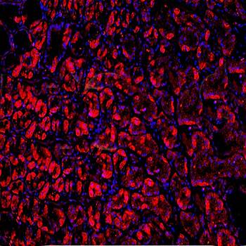 VPS18 antibody