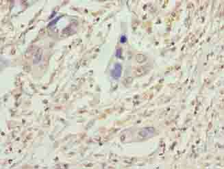 VPS25 Antibody