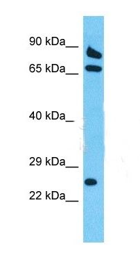 VPS26C antibody