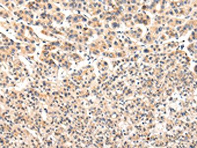 VPS33A Antibody