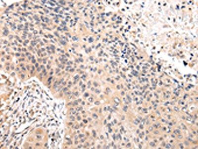 VPS33A Antibody