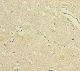 VPS33B Antibody