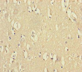 VPS33B Antibody