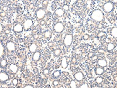 VPS33B Antibody