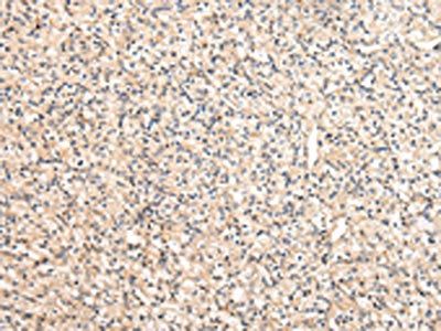 VPS33B Antibody