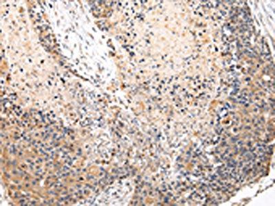 VPS37A Antibody