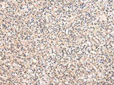 VPS37A Antibody