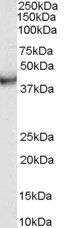VPS37C antibody