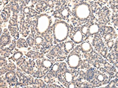 VPS37D Antibody