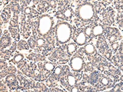 VPS37D antibody