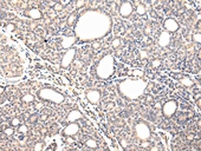 VPS37D Antibody