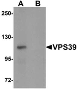 VPS39 Antibody