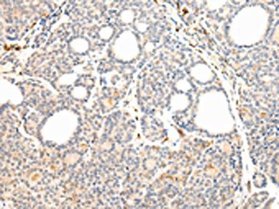VPS41 Antibody