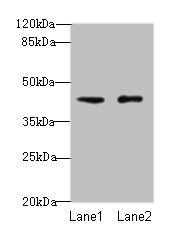 VPS45 Antibody