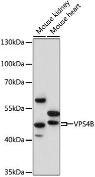 VPS4B antibody