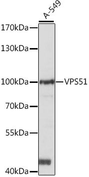 VPS51 antibody
