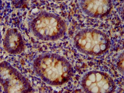 VPS52 Antibody