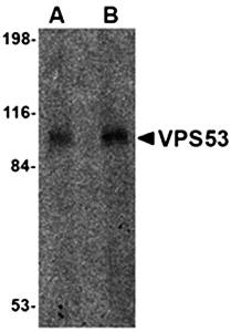 VPS53 Antibody