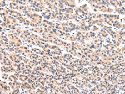 VPS54 antibody