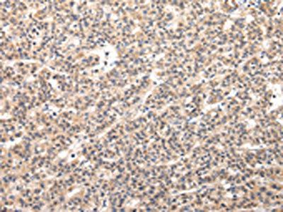 VPS54 Antibody
