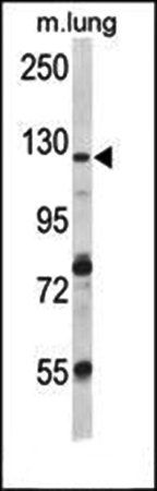VPS54 antibody