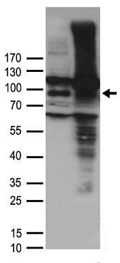 VR1 (TRPV1) antibody