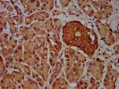 VRK2 Antibody
