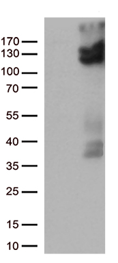 VRL1 (TRPV2) antibody