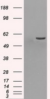 VRL1 (TRPV2) antibody