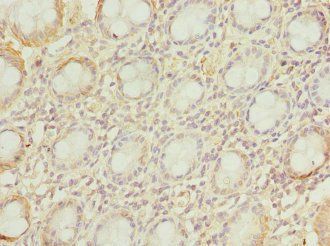 VSNL1 Antibody