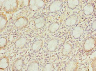 VSNL1 antibody