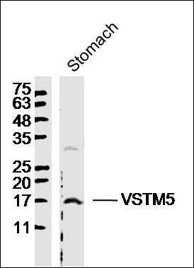 VSTM5 antibody