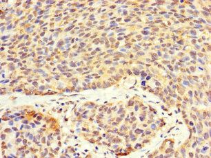 VTA1 Antibody