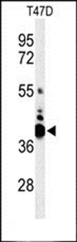VTCN1 antibody