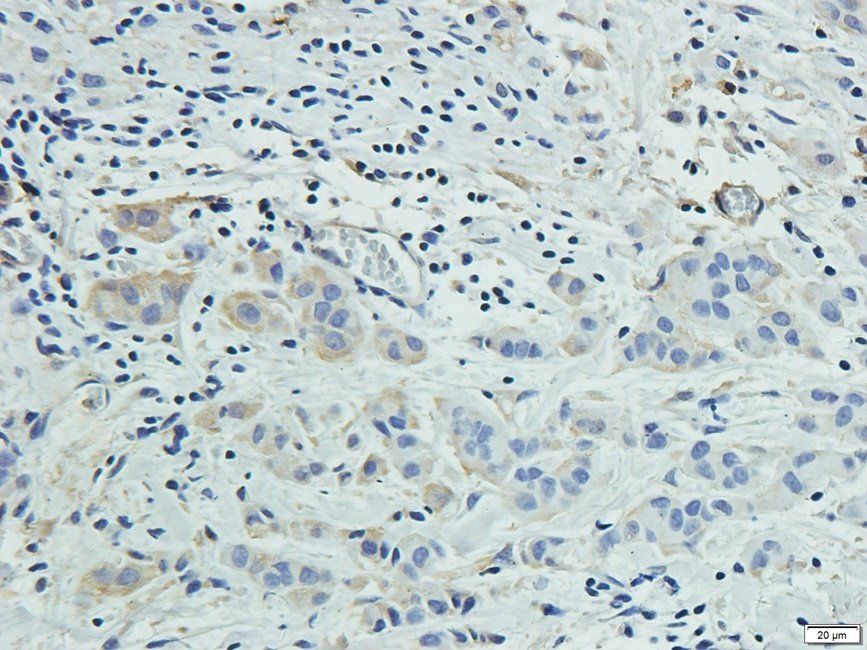 VTI1A Rabbit Polyclonal Antibody