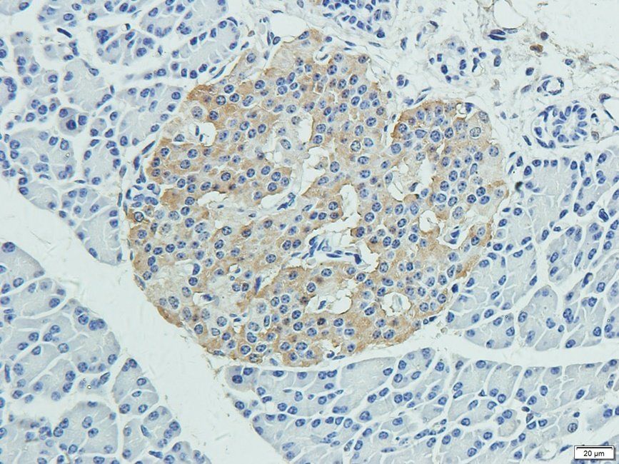 VTI1A Rabbit Polyclonal Antibody