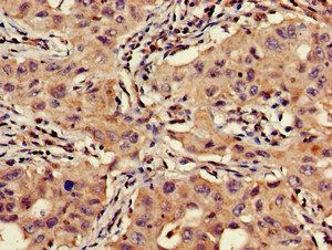 VTI1A Antibody