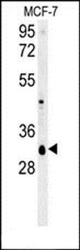 VTI1B antibody