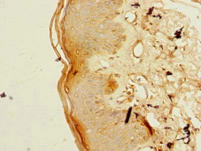 VWA3B Antibody
