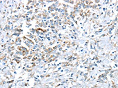 VWCE Antibody