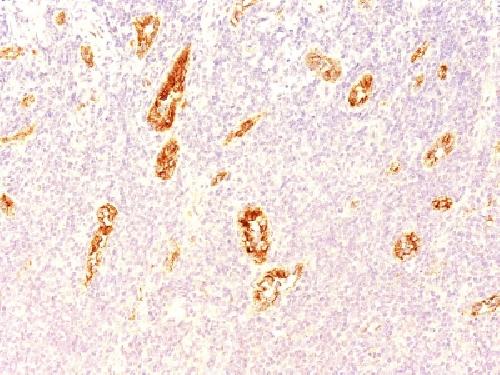 von Willebrand Factor / Factor VIII Related-Ag (Endothelial Marker) Antibody