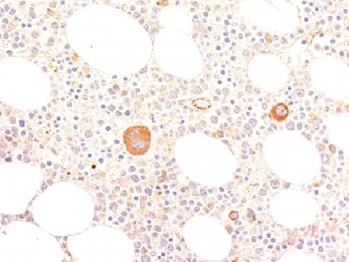 von Willebrand Factor / Factor VIII Related-Ag (Endothelial Marker) Antibody
