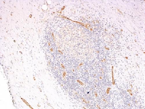 von Willebrand Factor / Factor VIII Related-Ag (Endothelial Marker) Antibody