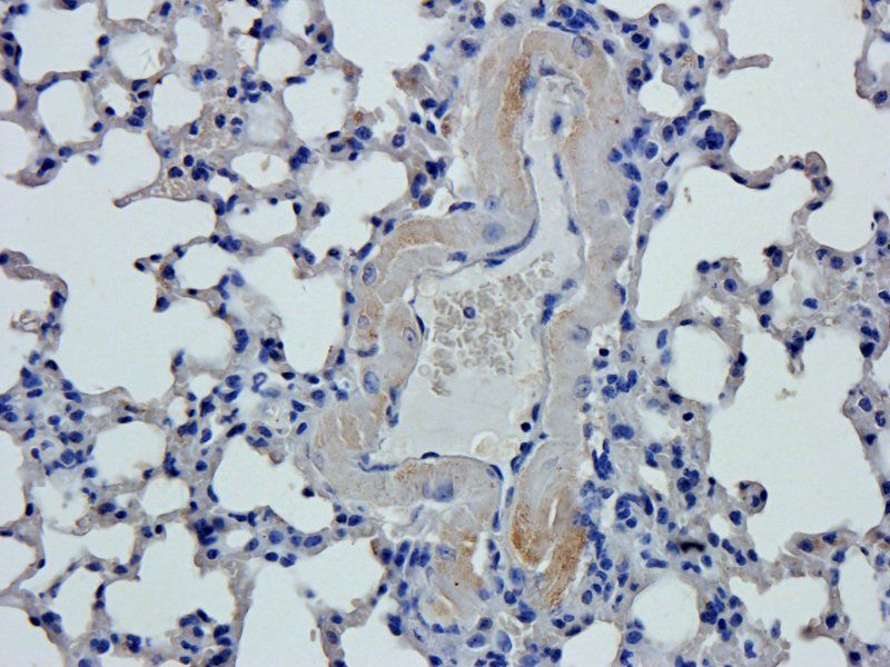 vWF Rabbit Polyclonal Antibody