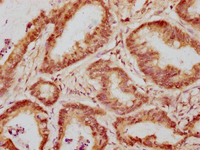 WAPL Antibody