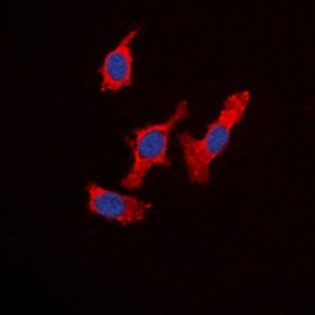 WASF1 antibody