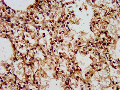 WASF2 Antibody