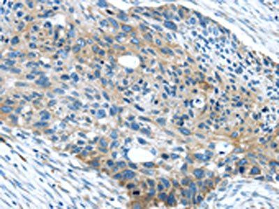 WASF2 Antibody