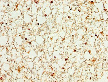 WASF3 Antibody